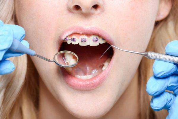 Tratamento Ortodontico No Adulto